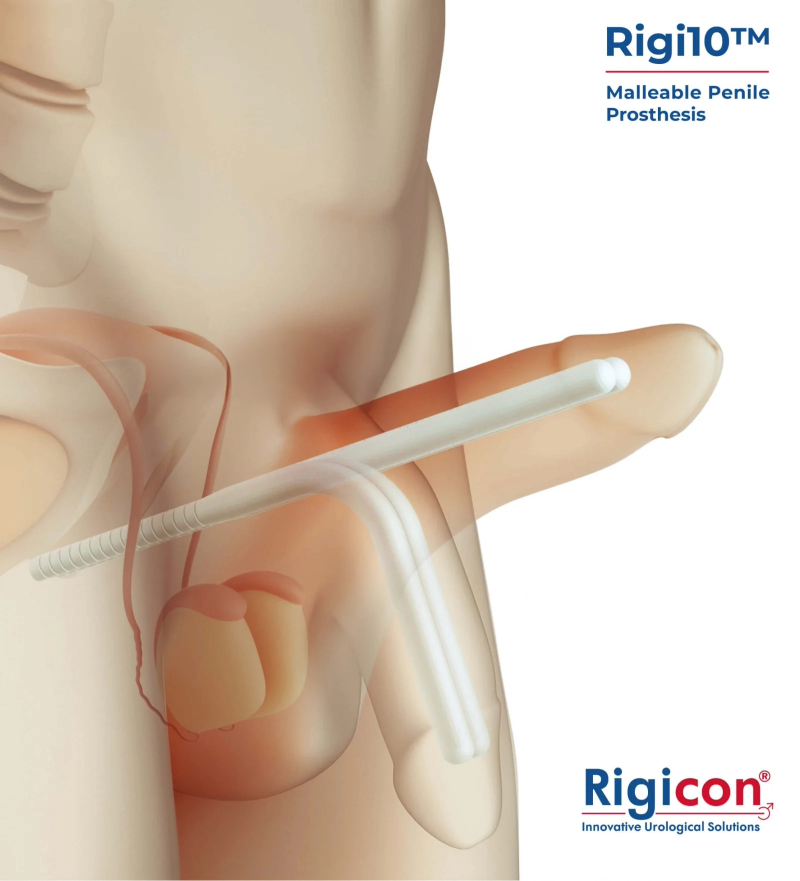Rigi10™ Malleable Penile Implant
